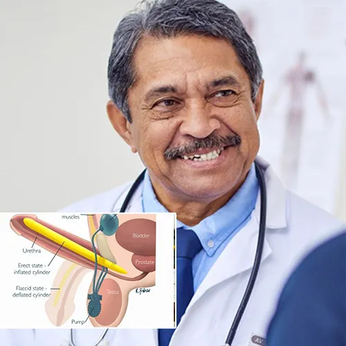 Choosing Virtua Center for Surgery


 for Your Penile Implant