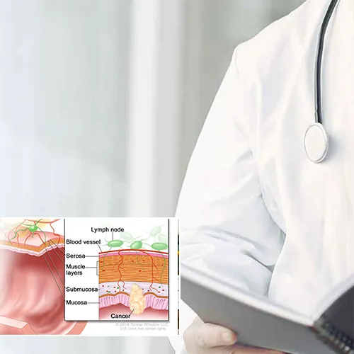 Lifespan and Reliability of Penile Implants