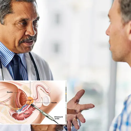 Is an Inflatable Penile Implant Right for You?